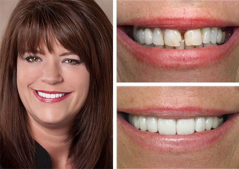 Cosmetic Dentist Chesapeake Virginia