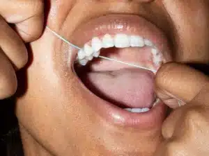 How to protect your teeth from acid erosion