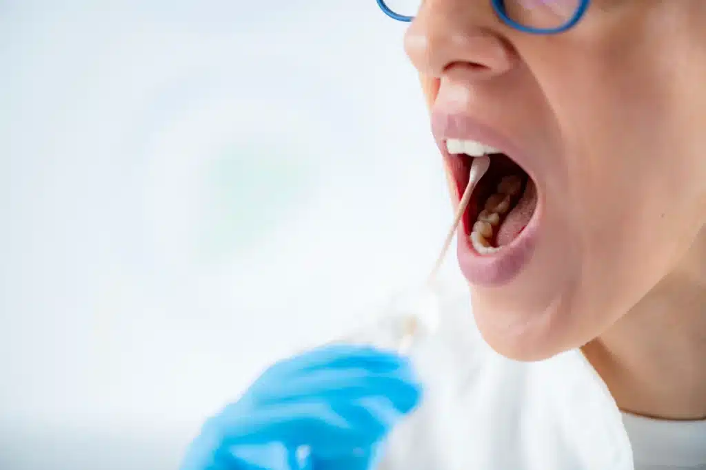 OralDNA Bacterial testing