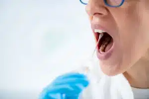 OralDNA Bacterial testing