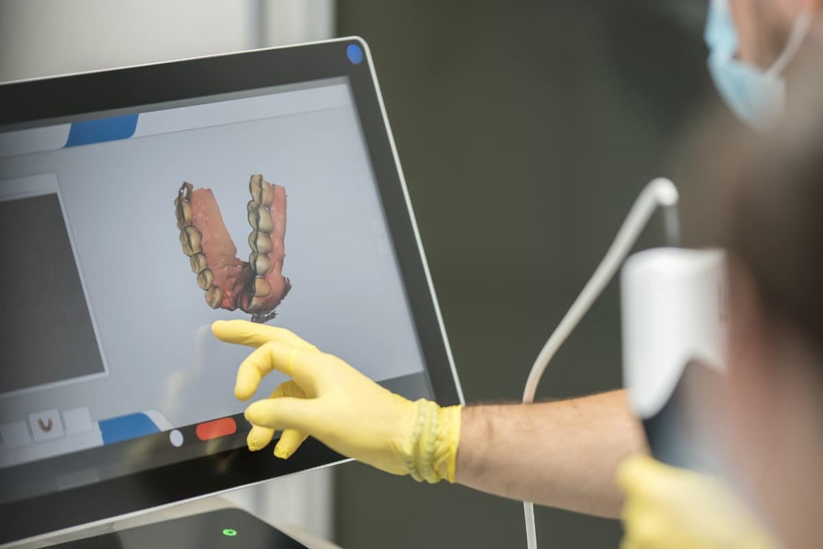 Dentist wearing gloves reviewing a 3D digital dental scan on a touchscreen monitor during treatment planning.