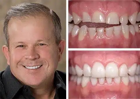 A brighter, healthier smile—expertly restored through personalized cosmetic dentistry care.