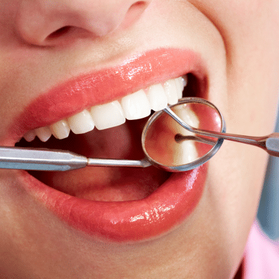 Closeup of a woman getting dental work done, representing first dental visit