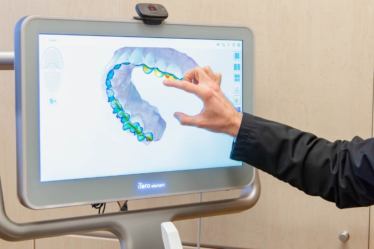 iTero digital scanner showing 3D dental imaging at a top-rated Chesapeake dental office.
