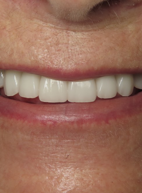 The Center for Cosmetic & Restorative Dentistry