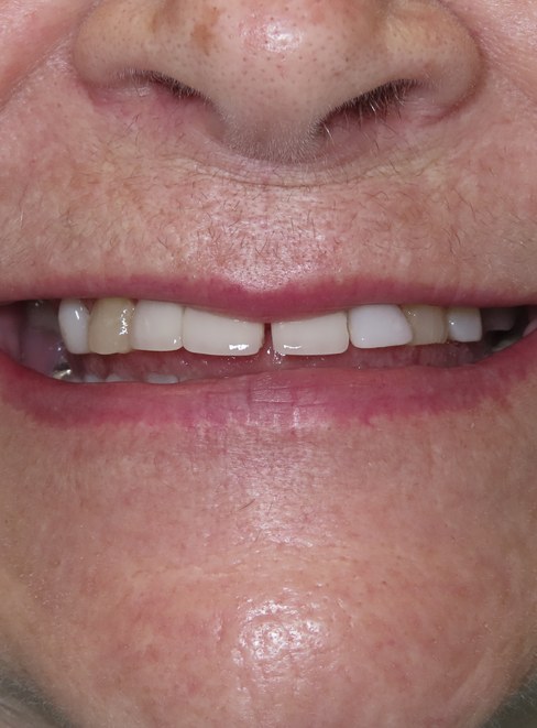 The Center for Cosmetic & Restorative Dentistry