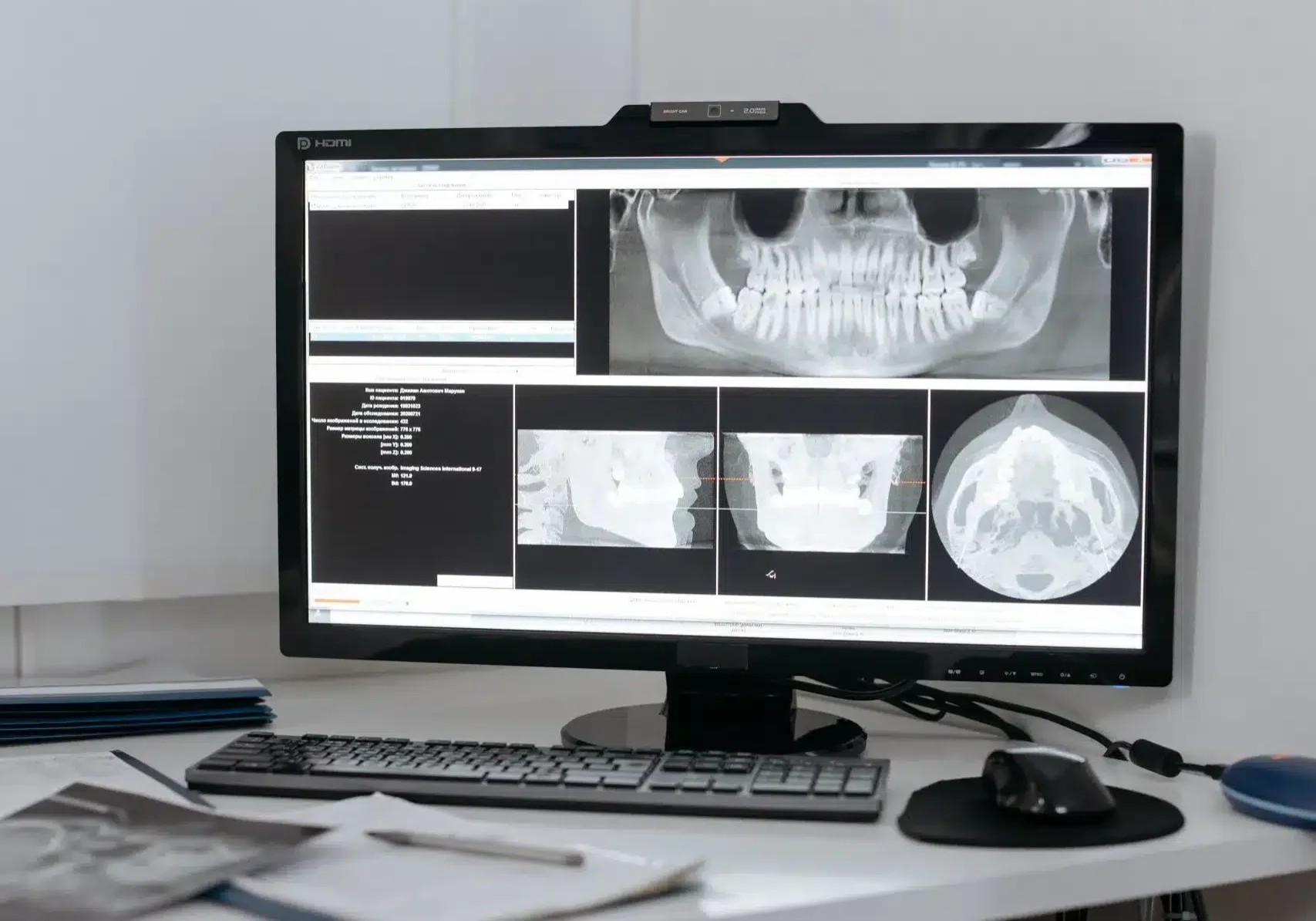 Digital X-Rays